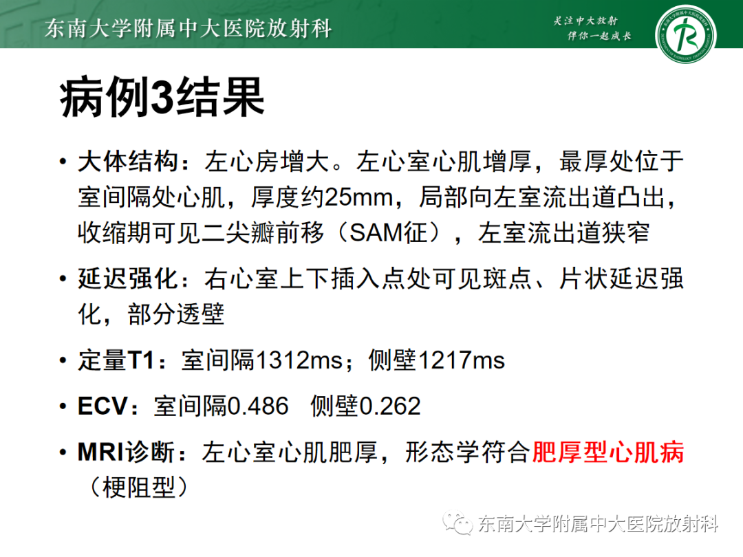 影像PPT - 【PPT】心肌淀粉样变-19
