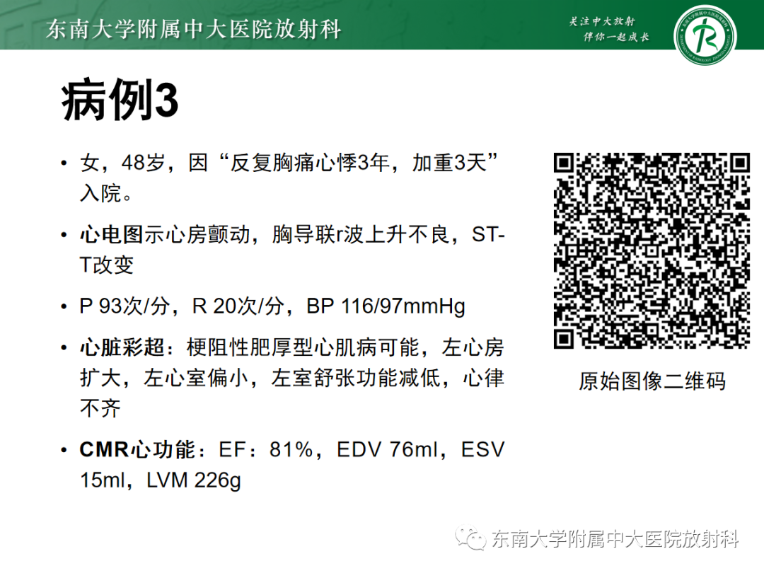 影像PPT - 【PPT】心肌淀粉样变-14