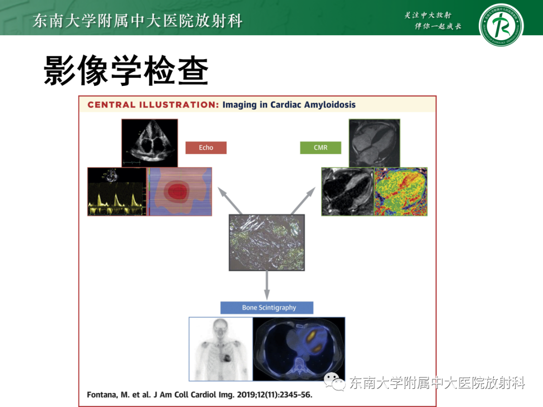 影像PPT - 【PPT】心肌淀粉样变-26
