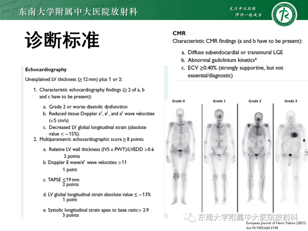 影像PPT - 【PPT】心肌淀粉样变-30
