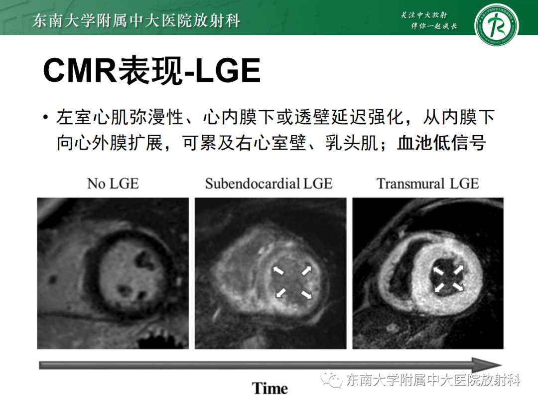 影像PPT - 【PPT】心肌淀粉样变-33