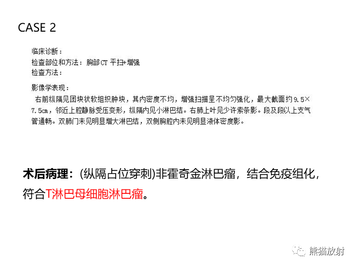 影像PPT - 【病例】纵隔淋巴瘤2例CT影像-16