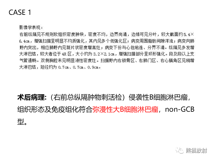 影像PPT - 【病例】纵隔淋巴瘤2例CT影像-15