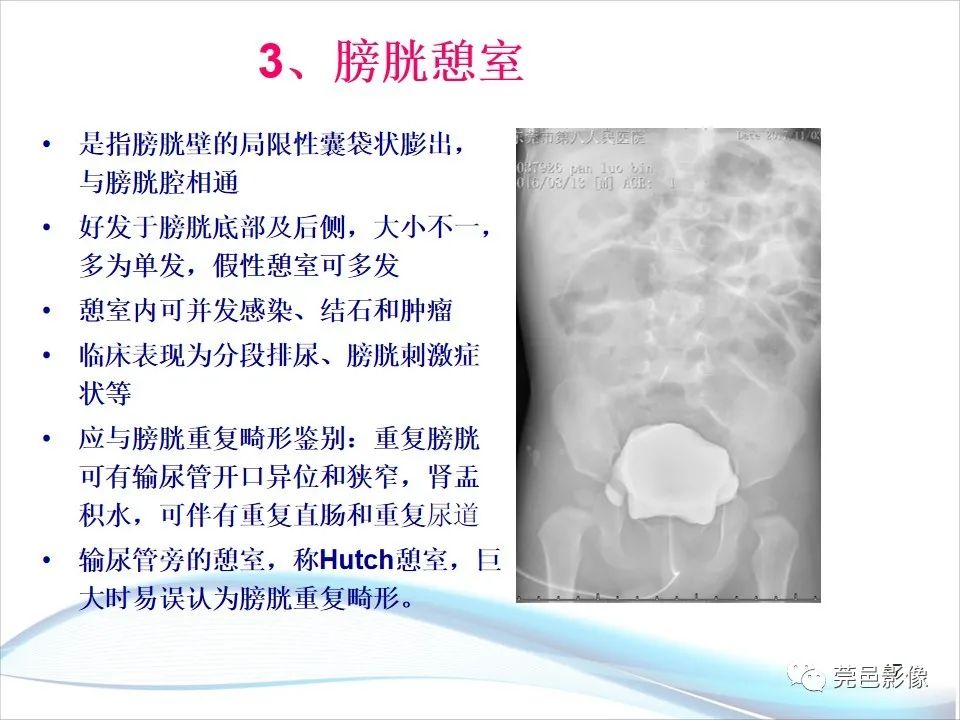 影像PPT - 【PPT】儿童膀胱造影流程及常见疾病诊断-17