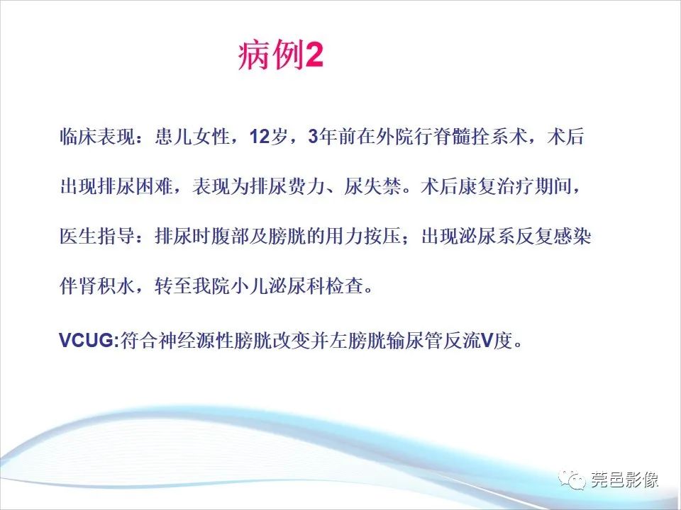 影像PPT - 【PPT】儿童膀胱造影流程及常见疾病诊断-45