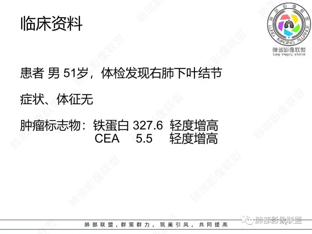 影像PPT - 【病例】肺内光滑实性结节的分析-2 影像PPT - 【病例】肺内光滑实性结节的分析-2