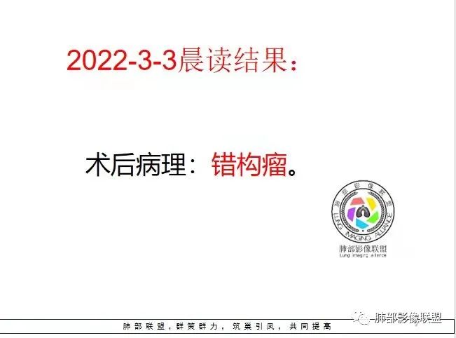 影像PPT - 【病例】肺内光滑实性结节的分析-22 影像PPT - 【病例】肺内光滑实性结节的分析-22