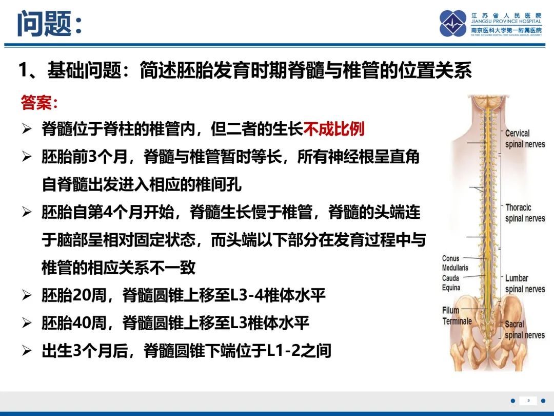 影像PPT - 【PPT】脂肪脊髓脊膜膨出-10