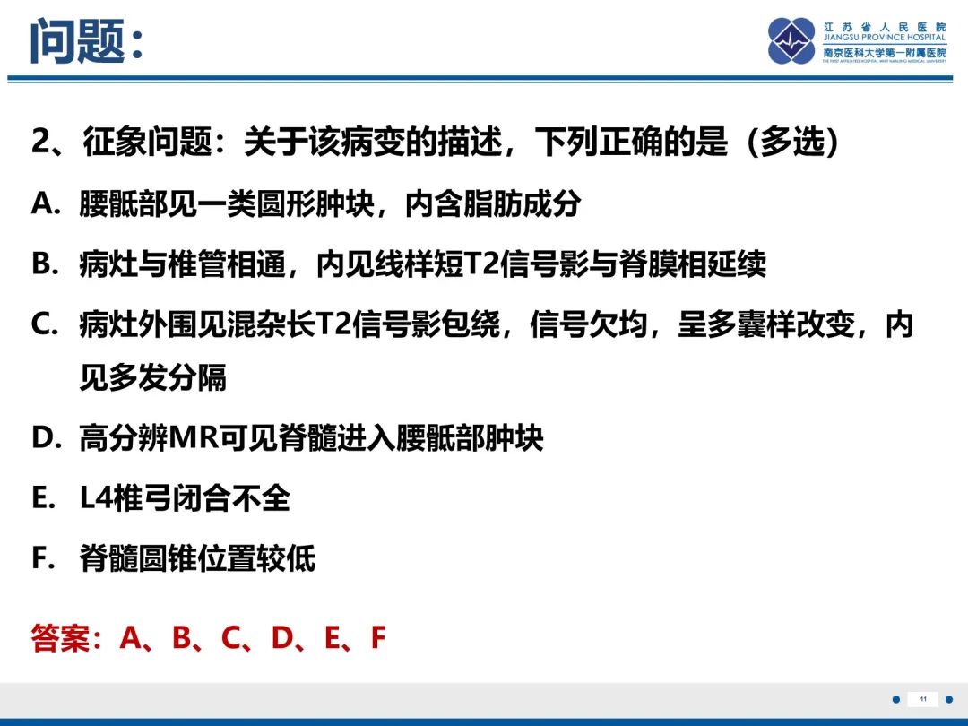 影像PPT - 【PPT】脂肪脊髓脊膜膨出-12