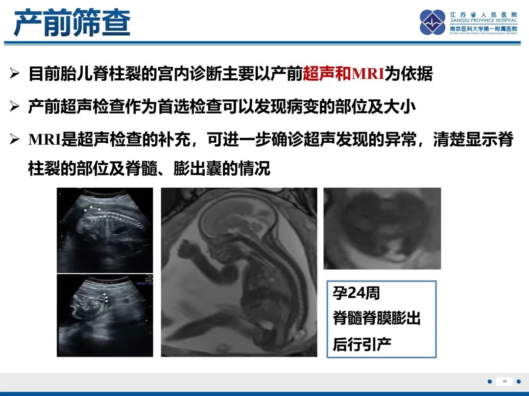 影像PPT - 【PPT】脂肪脊髓脊膜膨出-34