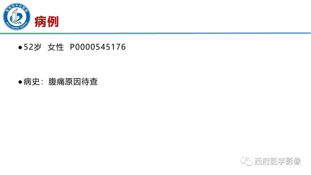 影像PPT - 【PPT】肠气囊肿影像诊断与鉴别-2