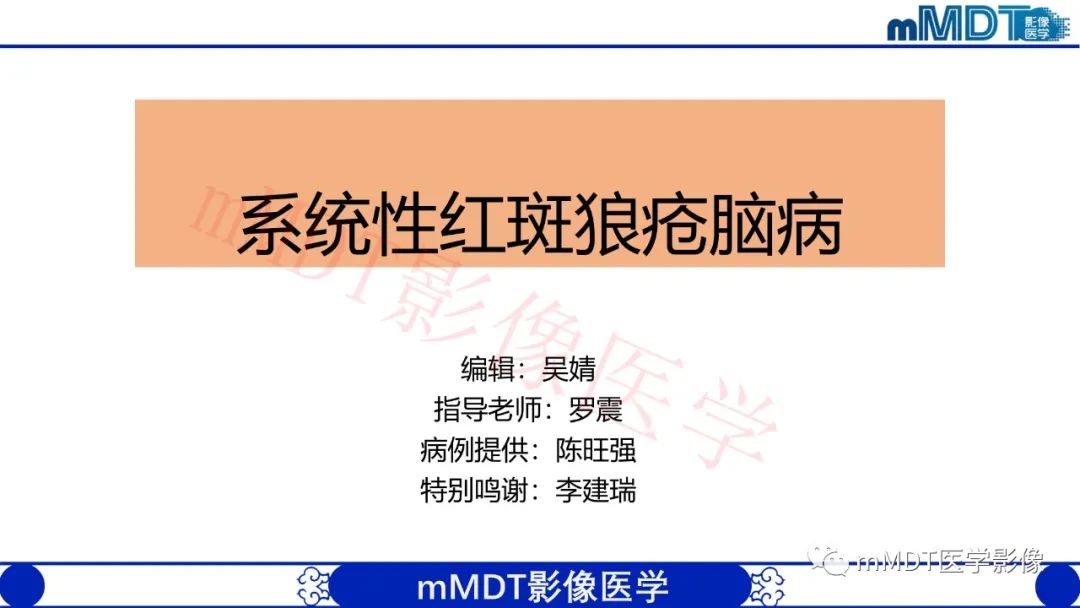 影像PPT - 【PPT】系统性红斑狼疮脑病-1 影像PPT - 【PPT】系统性红斑狼疮脑病-1