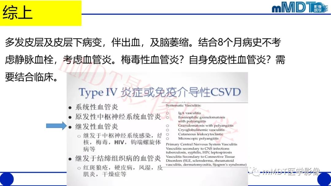影像PPT - 【PPT】系统性红斑狼疮脑病-9 影像PPT - 【PPT】系统性红斑狼疮脑病-9