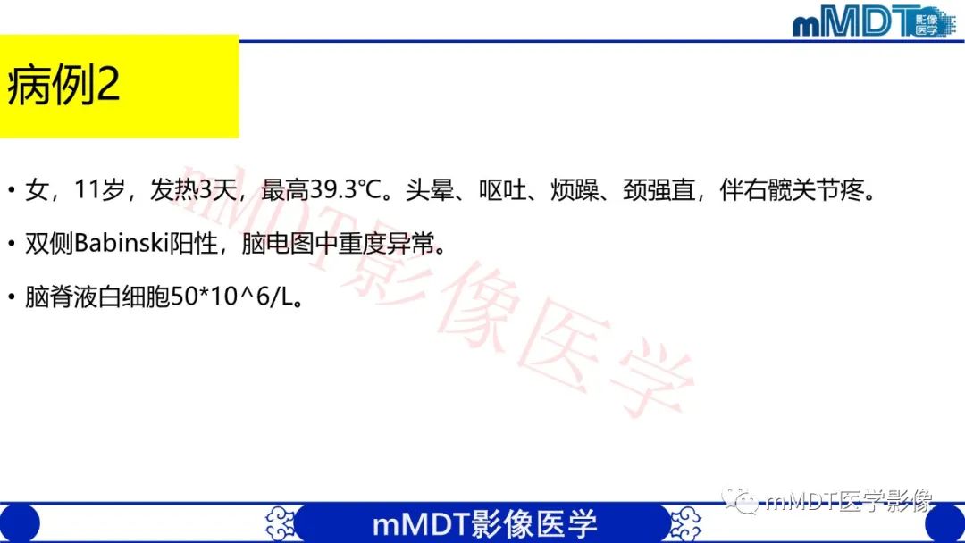 影像PPT - 【PPT】系统性红斑狼疮脑病-11 影像PPT - 【PPT】系统性红斑狼疮脑病-11
