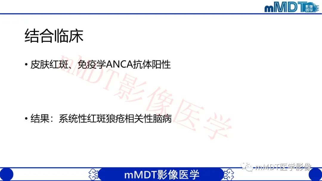 影像PPT - 【PPT】系统性红斑狼疮脑病-10 影像PPT - 【PPT】系统性红斑狼疮脑病-10