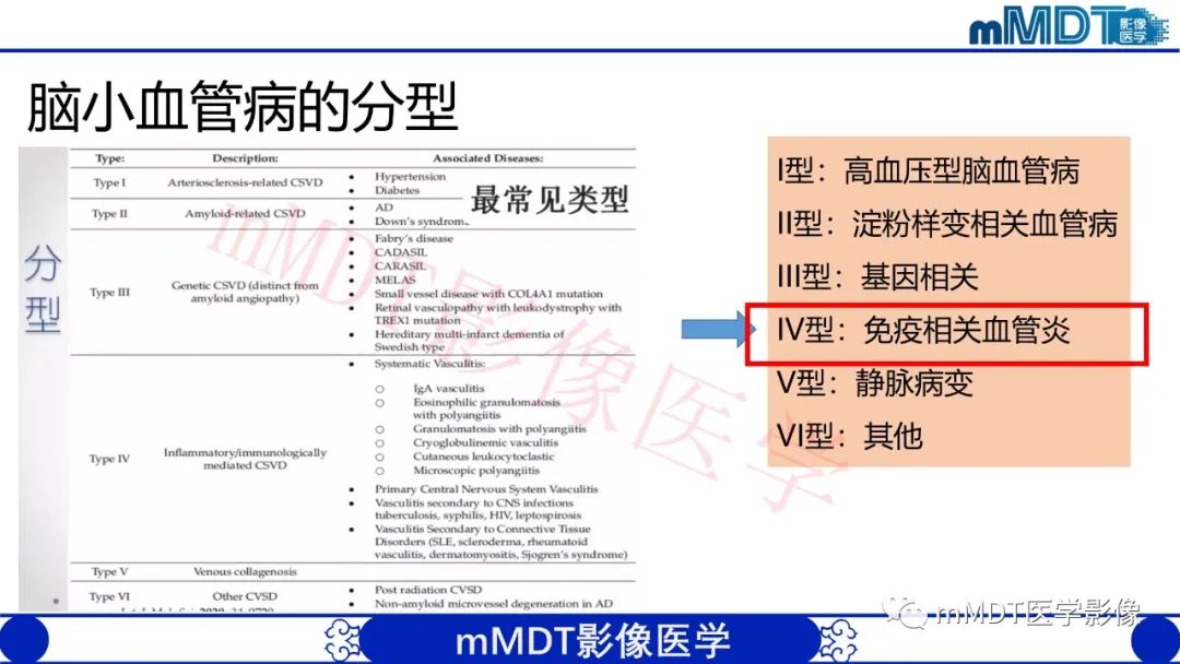 影像PPT - 【PPT】系统性红斑狼疮脑病-19 影像PPT - 【PPT】系统性红斑狼疮脑病-19