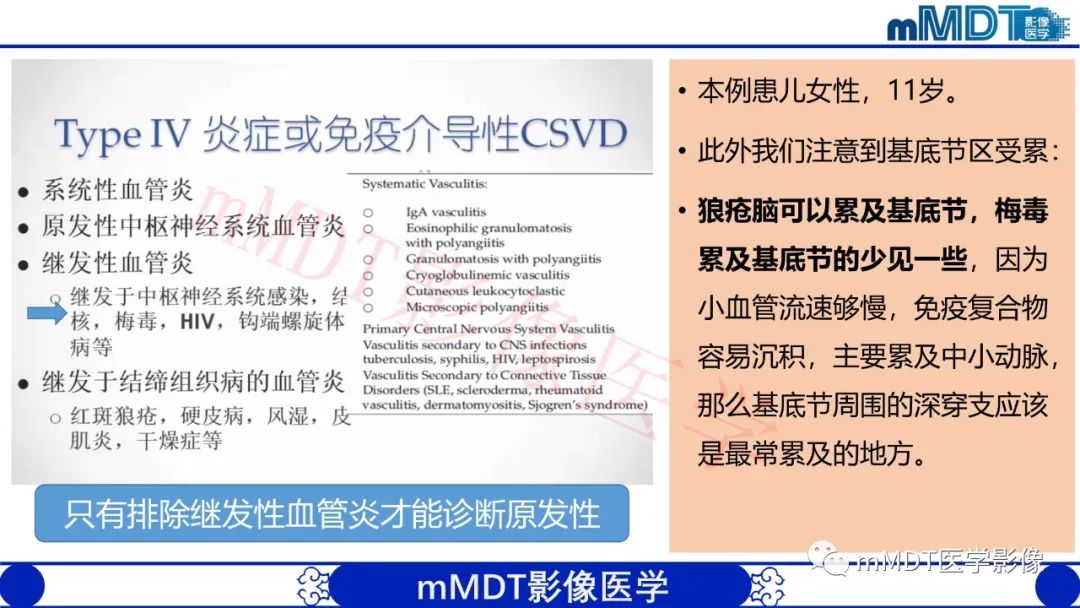影像PPT - 【PPT】系统性红斑狼疮脑病-20 影像PPT - 【PPT】系统性红斑狼疮脑病-20