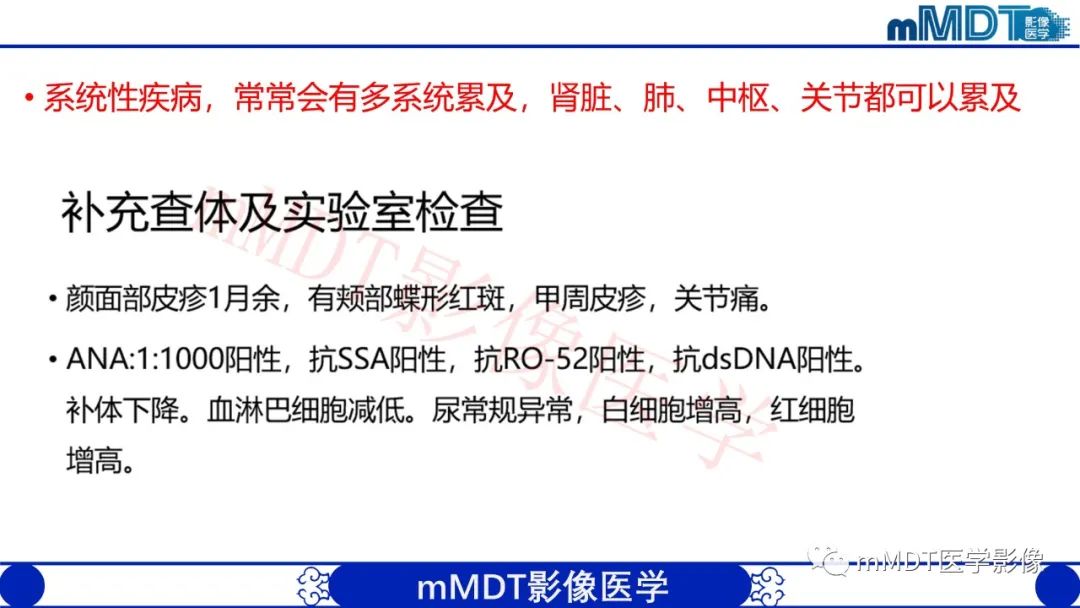 影像PPT - 【PPT】系统性红斑狼疮脑病-22 影像PPT - 【PPT】系统性红斑狼疮脑病-22