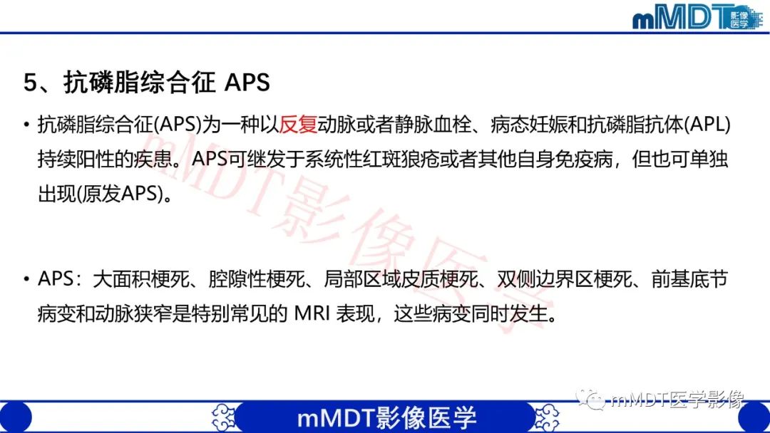 影像PPT - 【PPT】系统性红斑狼疮脑病-43 影像PPT - 【PPT】系统性红斑狼疮脑病-43