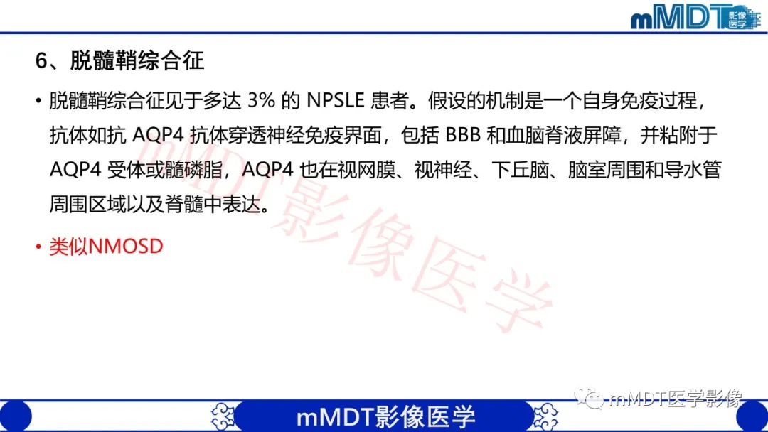影像PPT - 【PPT】系统性红斑狼疮脑病-45 影像PPT - 【PPT】系统性红斑狼疮脑病-45