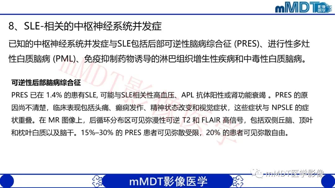 影像PPT - 【PPT】系统性红斑狼疮脑病-51 影像PPT - 【PPT】系统性红斑狼疮脑病-51