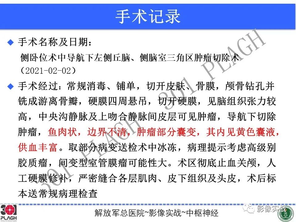 影像PPT - 【病例】幕上室管膜瘤1例MR影像-24