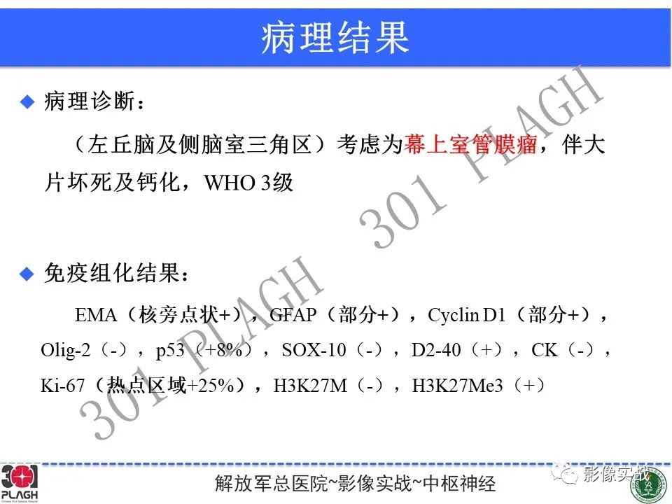 影像PPT - 【病例】幕上室管膜瘤1例MR影像-25