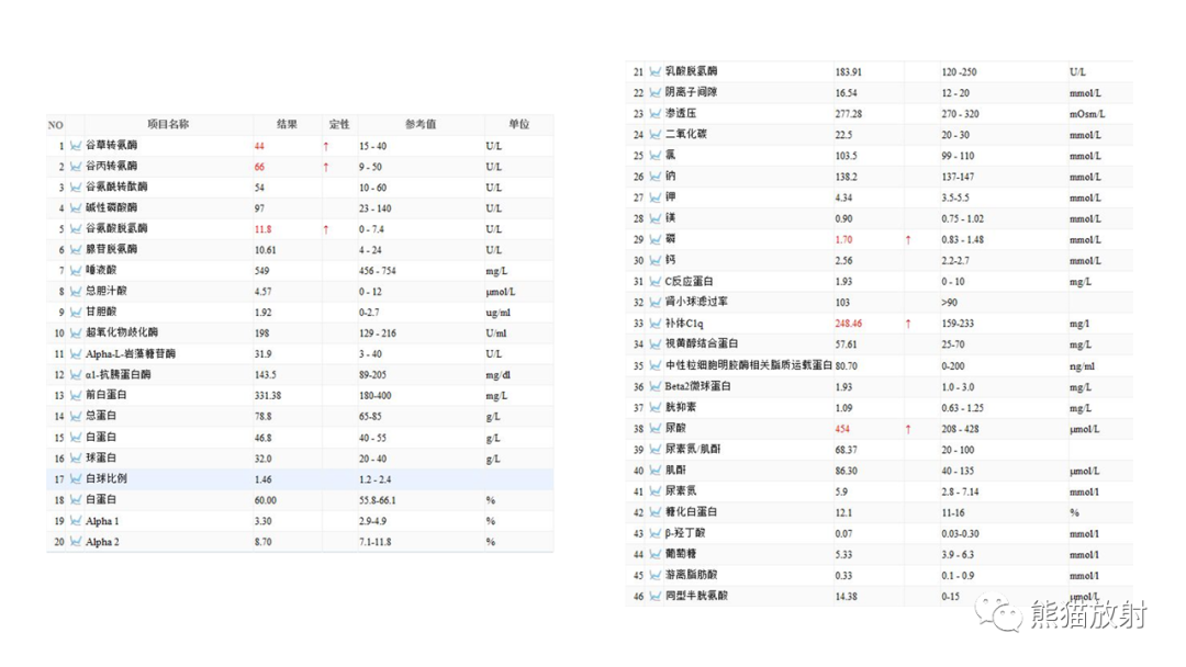 影像PPT - 【病例】长骨及脊柱朗格汉斯组织细胞增生症各1例-11