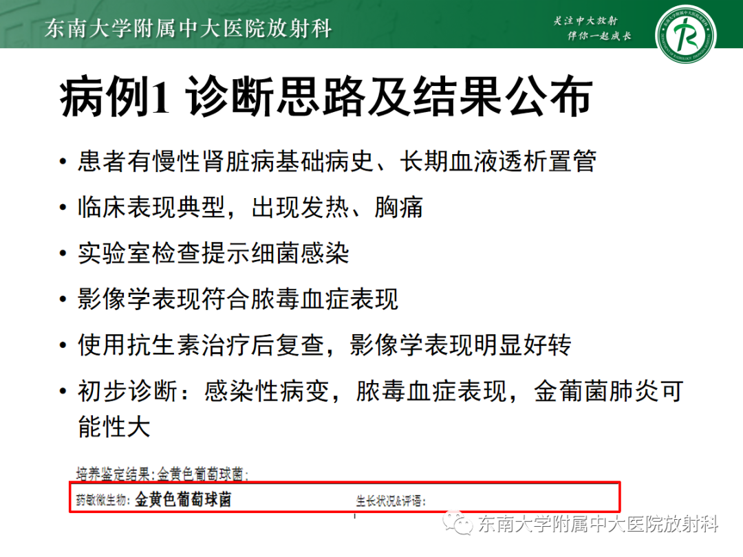 影像PPT - 【PPT】金黄色葡萄球菌肺炎-7 影像PPT - 【PPT】金黄色葡萄球菌肺炎-7