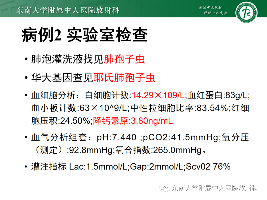 影像PPT - 【PPT】金黄色葡萄球菌肺炎-26 影像PPT - 【PPT】金黄色葡萄球菌肺炎-26