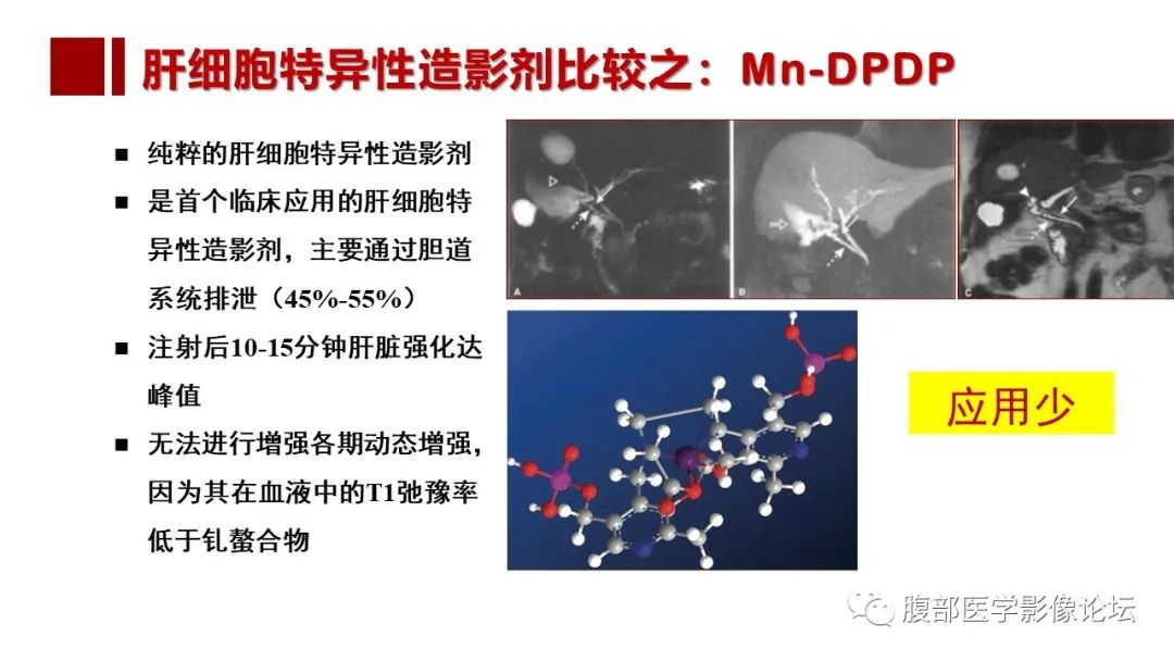 影像PPT - 【PPT】普美显胆管MR成像及其临床应用-9