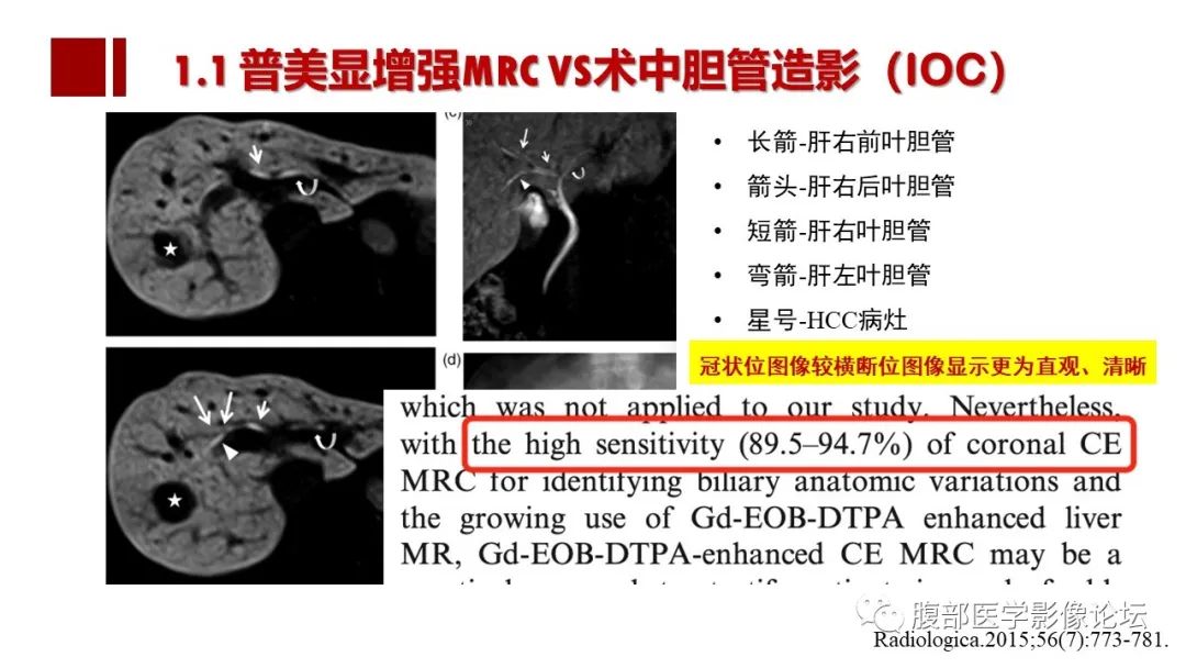 影像PPT - 【PPT】普美显胆管MR成像及其临床应用-27