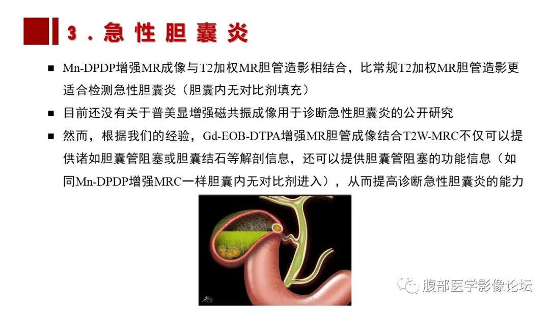 影像PPT - 【PPT】普美显胆管MR成像及其临床应用-38