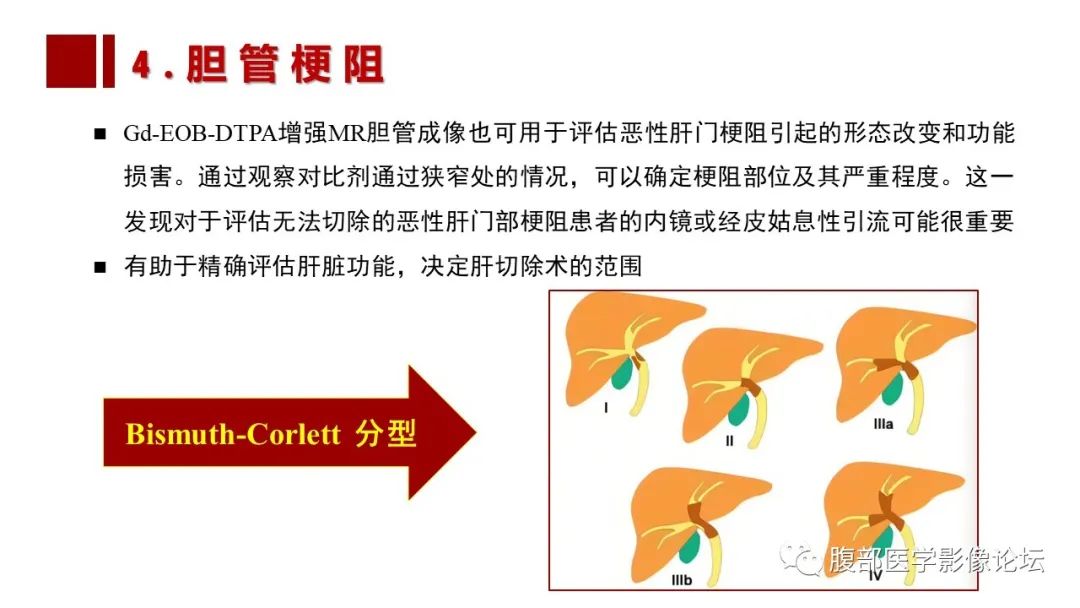 影像PPT - 【PPT】普美显胆管MR成像及其临床应用-43