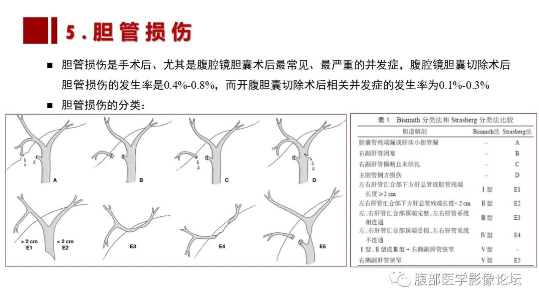 影像PPT - 【PPT】普美显胆管MR成像及其临床应用-45