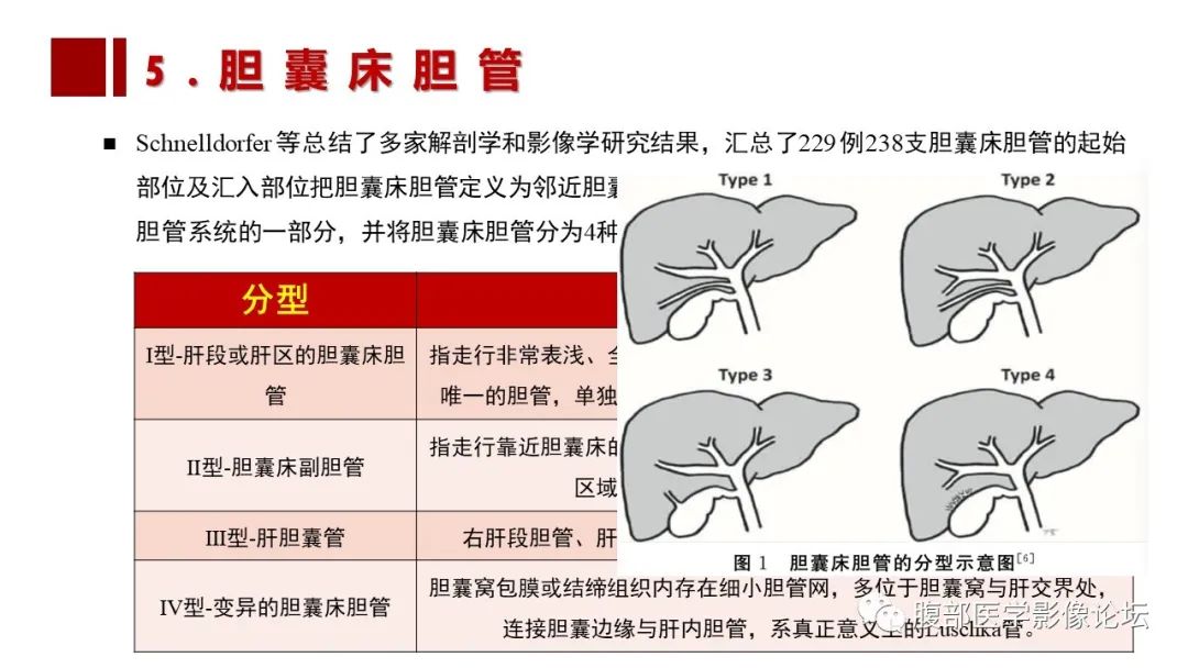 影像PPT - 【PPT】普美显胆管MR成像及其临床应用-48