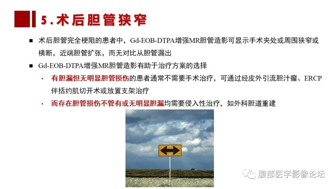 影像PPT - 【PPT】普美显胆管MR成像及其临床应用-52
