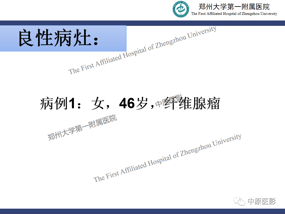 影像PPT - 【PPT】MRI对乳腺良恶性疾病的鉴别诊断-16