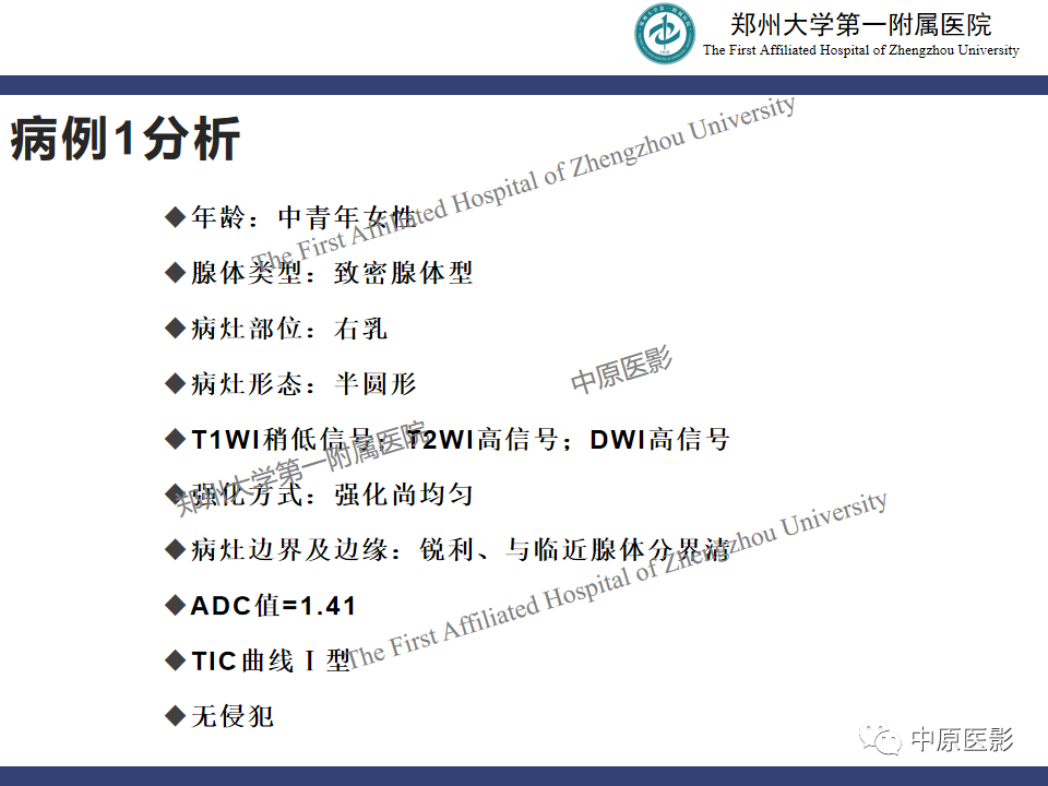 影像PPT - 【PPT】MRI对乳腺良恶性疾病的鉴别诊断-20