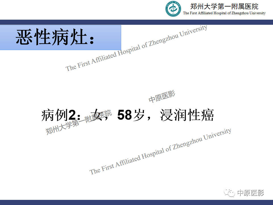 影像PPT - 【PPT】MRI对乳腺良恶性疾病的鉴别诊断-21