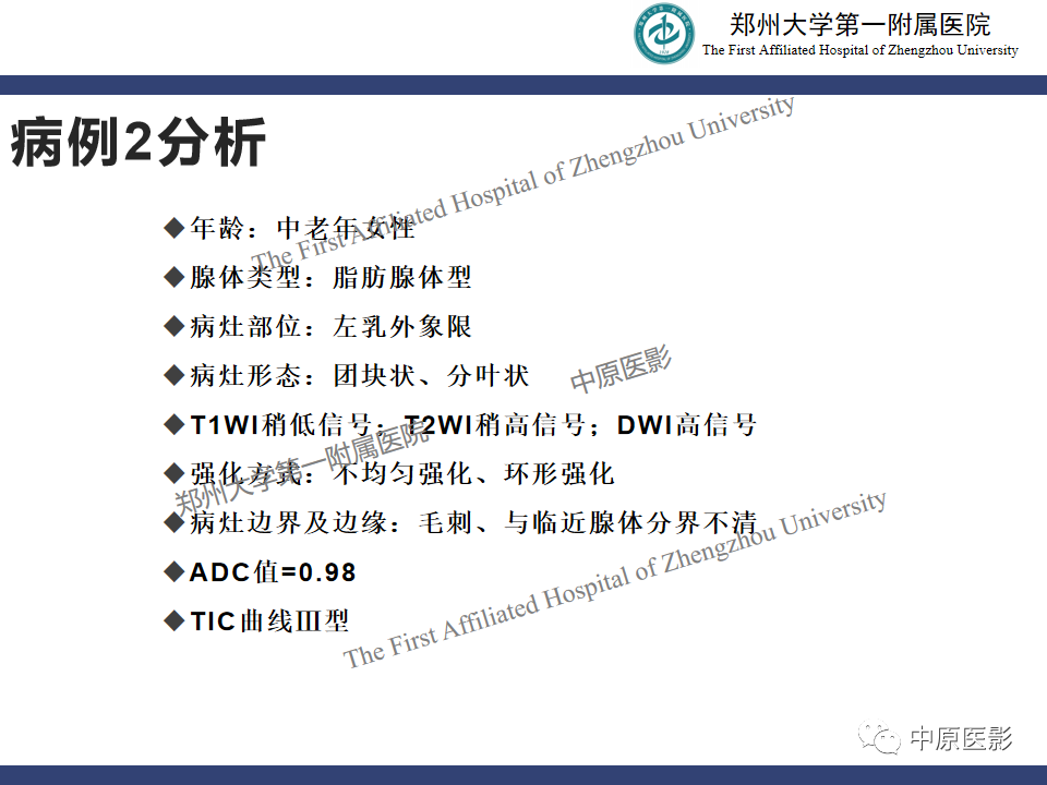 影像PPT - 【PPT】MRI对乳腺良恶性疾病的鉴别诊断-25