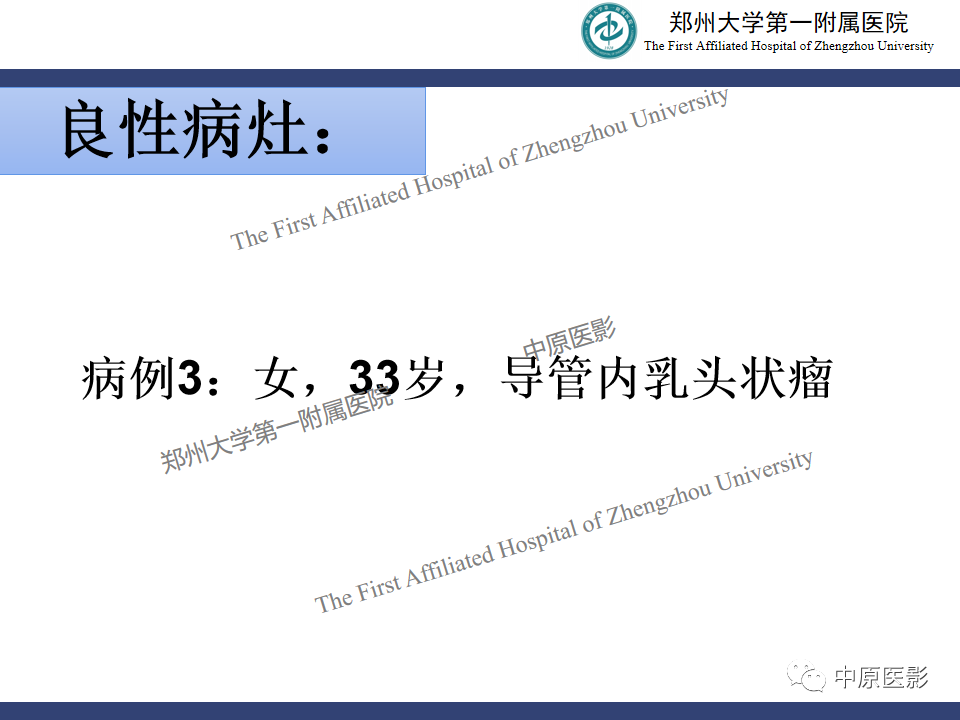 影像PPT - 【PPT】MRI对乳腺良恶性疾病的鉴别诊断-29