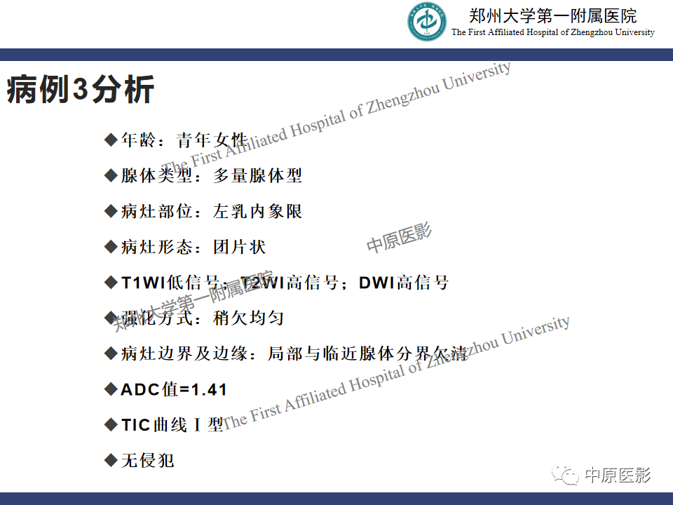 影像PPT - 【PPT】MRI对乳腺良恶性疾病的鉴别诊断-33