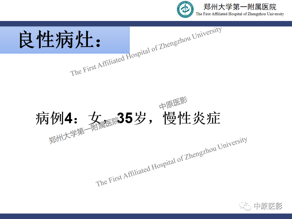 影像PPT - 【PPT】MRI对乳腺良恶性疾病的鉴别诊断-34