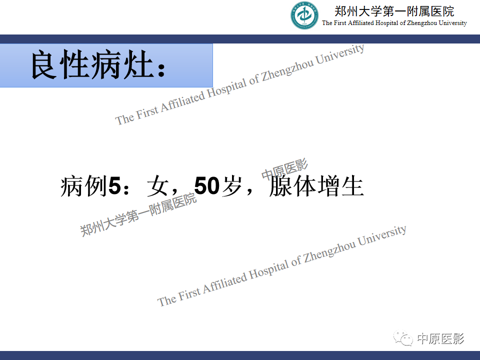 影像PPT - 【PPT】MRI对乳腺良恶性疾病的鉴别诊断-39