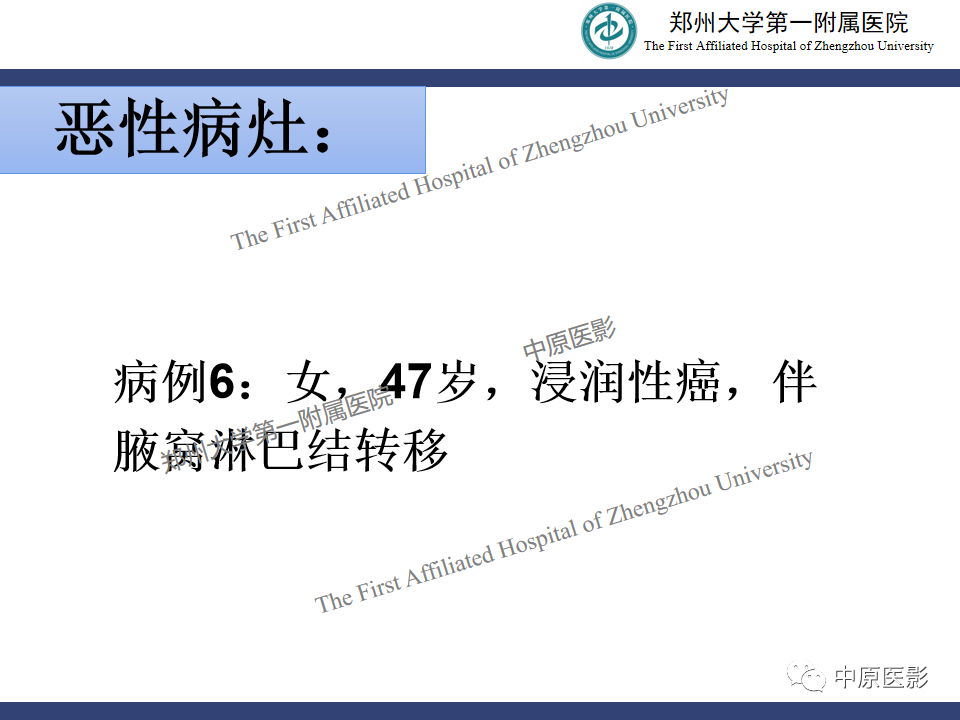 影像PPT - 【PPT】MRI对乳腺良恶性疾病的鉴别诊断-45