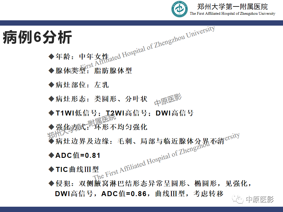 影像PPT - 【PPT】MRI对乳腺良恶性疾病的鉴别诊断-51