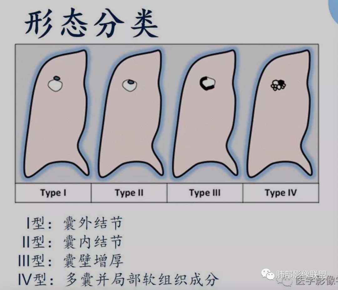 影像PPT - 【病例】 这例肺部空洞性病变影像分析应该读一读-36 影像PPT - 【病例】 这例肺部空洞性病变影像分析应该读一读-36