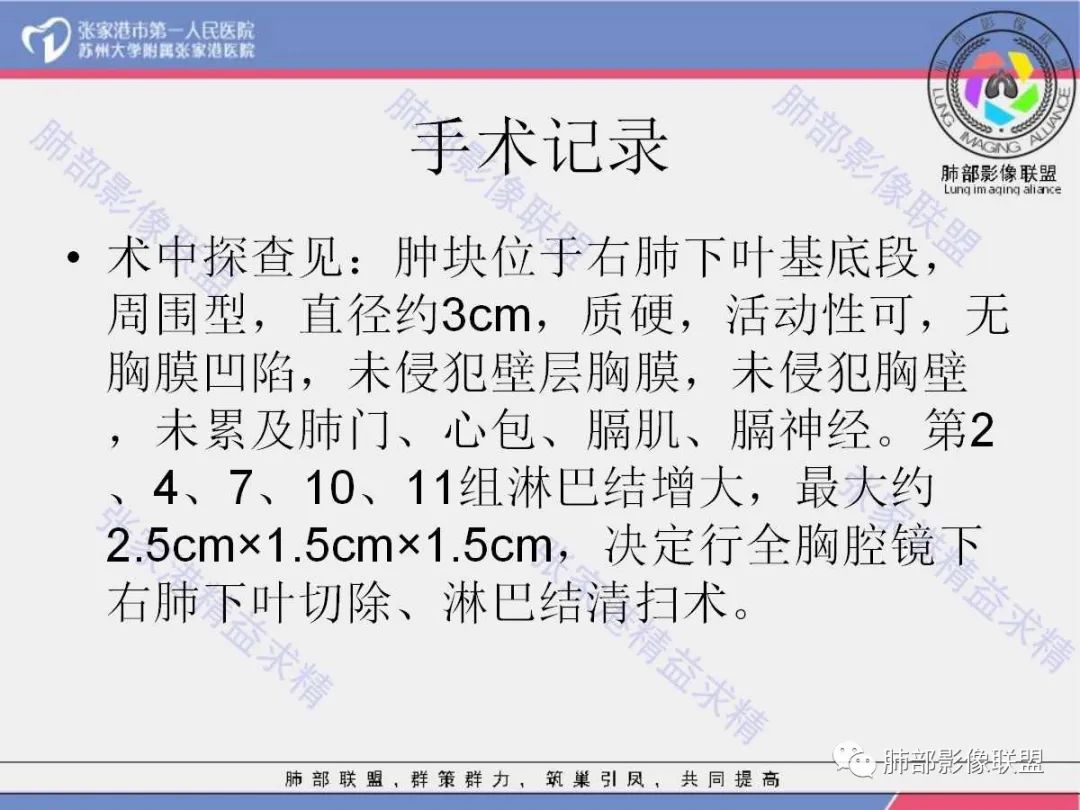 影像PPT - 【病例】 这例肺部空洞性病变影像分析应该读一读-45 影像PPT - 【病例】 这例肺部空洞性病变影像分析应该读一读-45