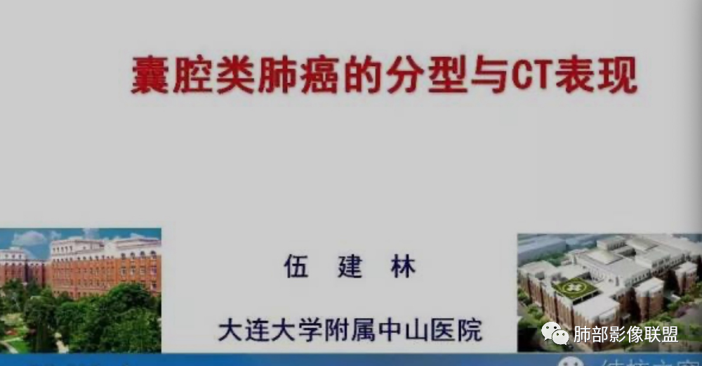 影像PPT - 【病例】 这例肺部空洞性病变影像分析应该读一读-64 影像PPT - 【病例】 这例肺部空洞性病变影像分析应该读一读-64
